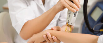 Процесс лазерной эпиляции рук